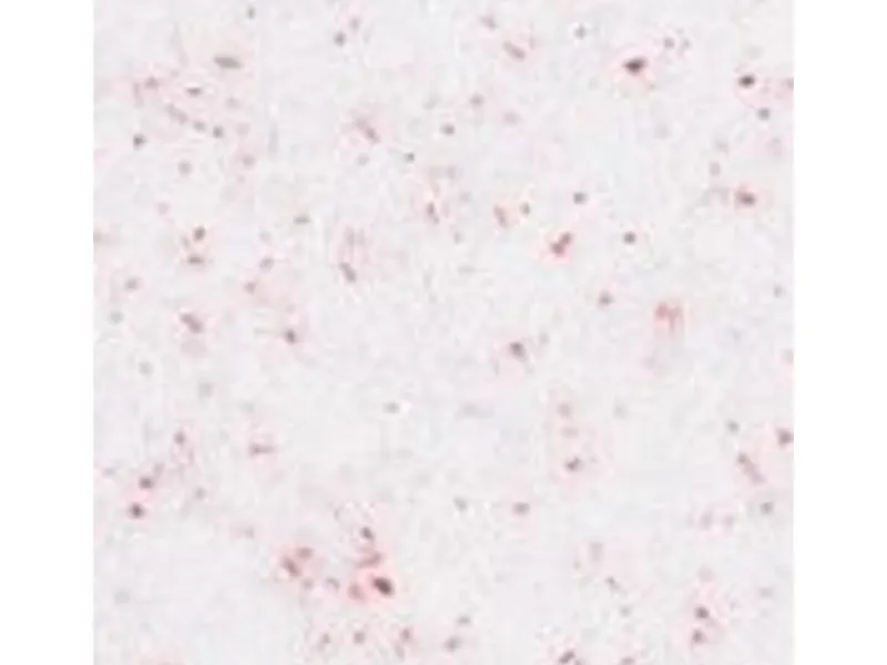 Terralith Buntsteinputz Mosaikputz 1mm -15 kg- BSP1126 Weiss Rot